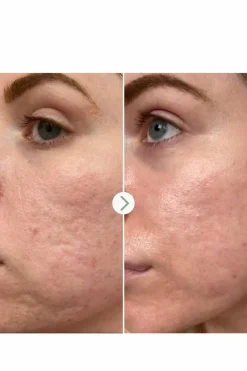 New PAI Booster hydratant Acide Hyaluronique