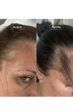 Outlet Omum Compléments Alimentaires croissance cheveux Mon Coup de Pousse Nutricosmétique