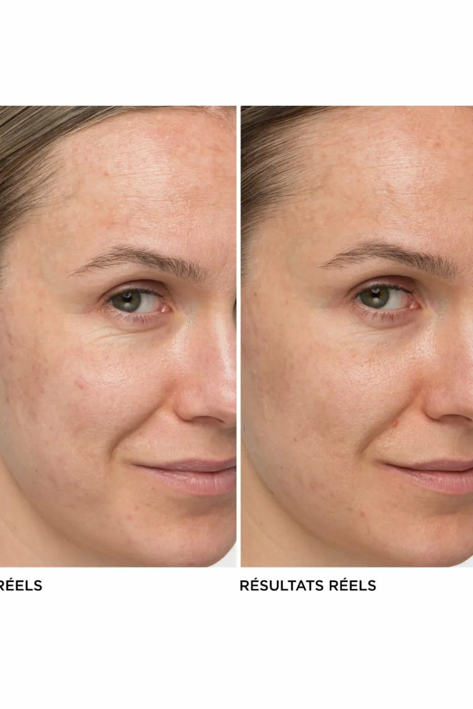 New it Cosmetics Crème anti-âge hydratante Confidence in a Cream™