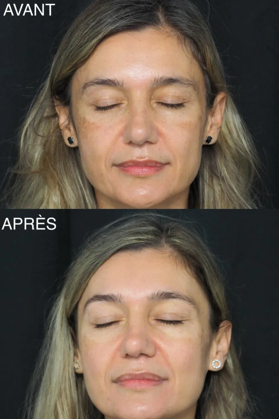 Sale Patyka Fluide anti-taches haute protection SPF30