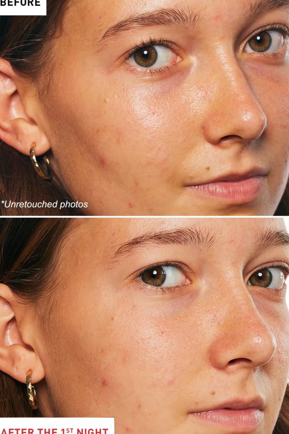 Hot Erborian Huile de nuit multi-perfectrice Skin Therapy