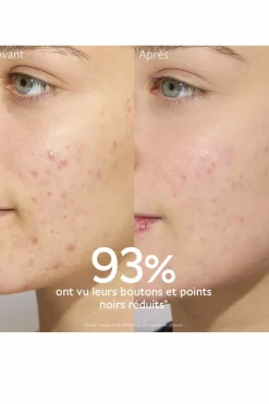 Sale Caudalie Kit anti-acné Vinopure