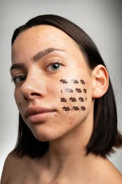 New Skin & Out Patch large zone XL Clear out