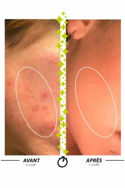 Sale Garancia Pâte purifiante anti-imperfections Sulfureuse Pâte du Marabout