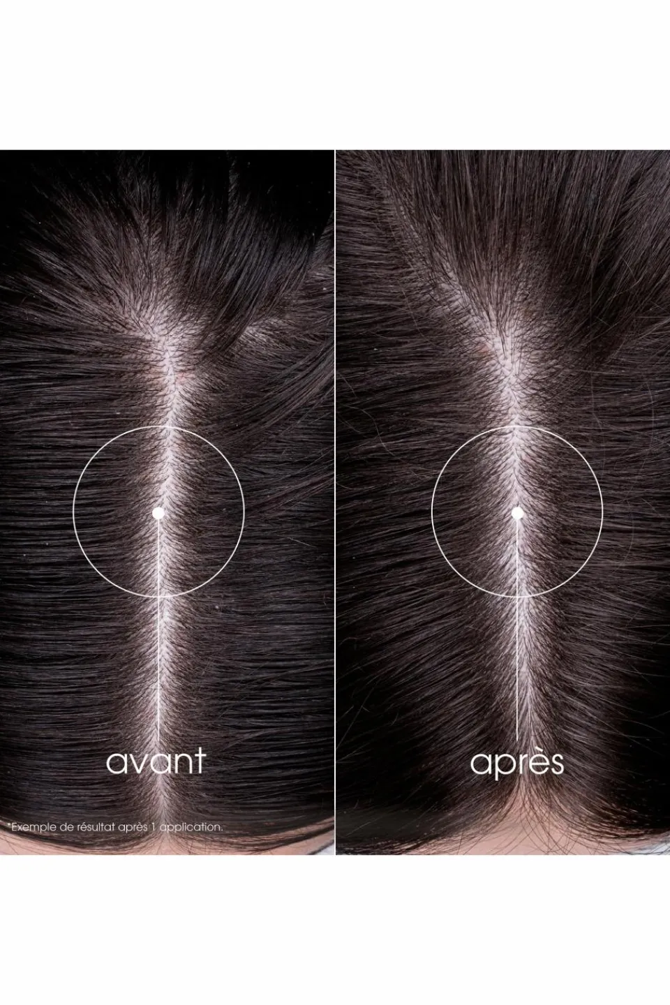 Hot Klorane Shampoing fortifiant à la Quinine & Edelweiss bio