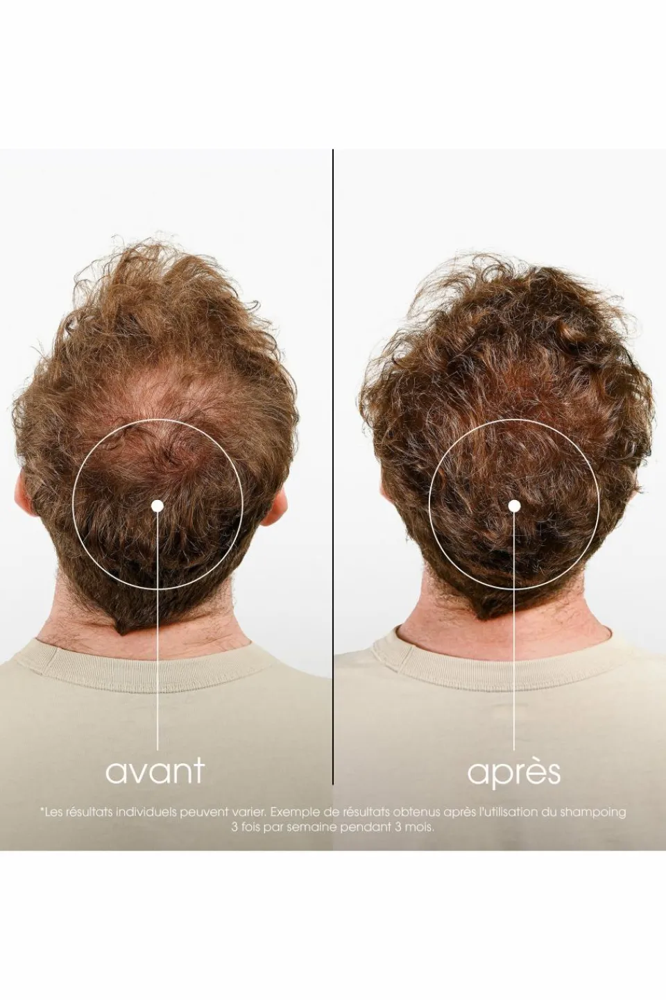 Hot Klorane Shampoing fortifiant à la Quinine & Edelweiss bio