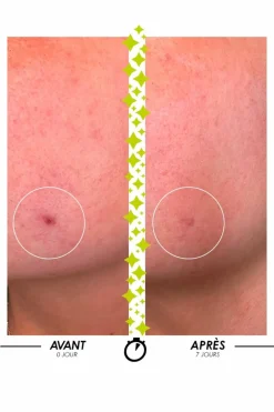 Sale Garancia Sérum anti-imperfections concentré Elixir du Marabout®