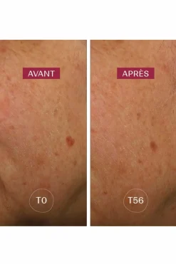 Discount LABORATOIRES DE BIARRITZ Sérum anti-taches