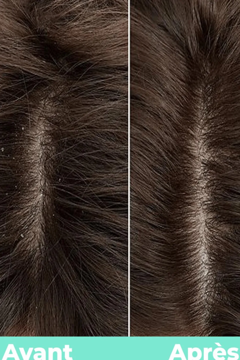 Clearance Energie Fruit Sérum détox cure SOS pour cuir chevelu hydra équilibrant